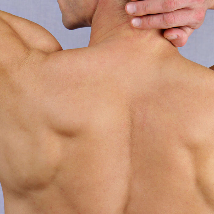 Epilation épaule homme